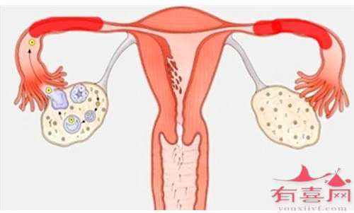 如果你的输卵管是开放和封闭的，你能怀孕吗？