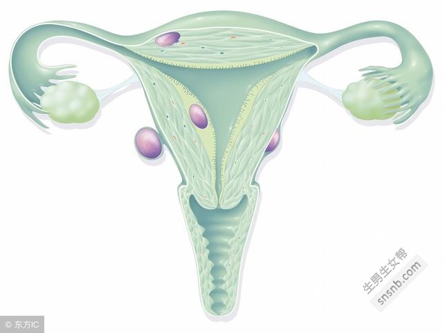 子宫肌瘤主要表现在这4个方面，你要预防